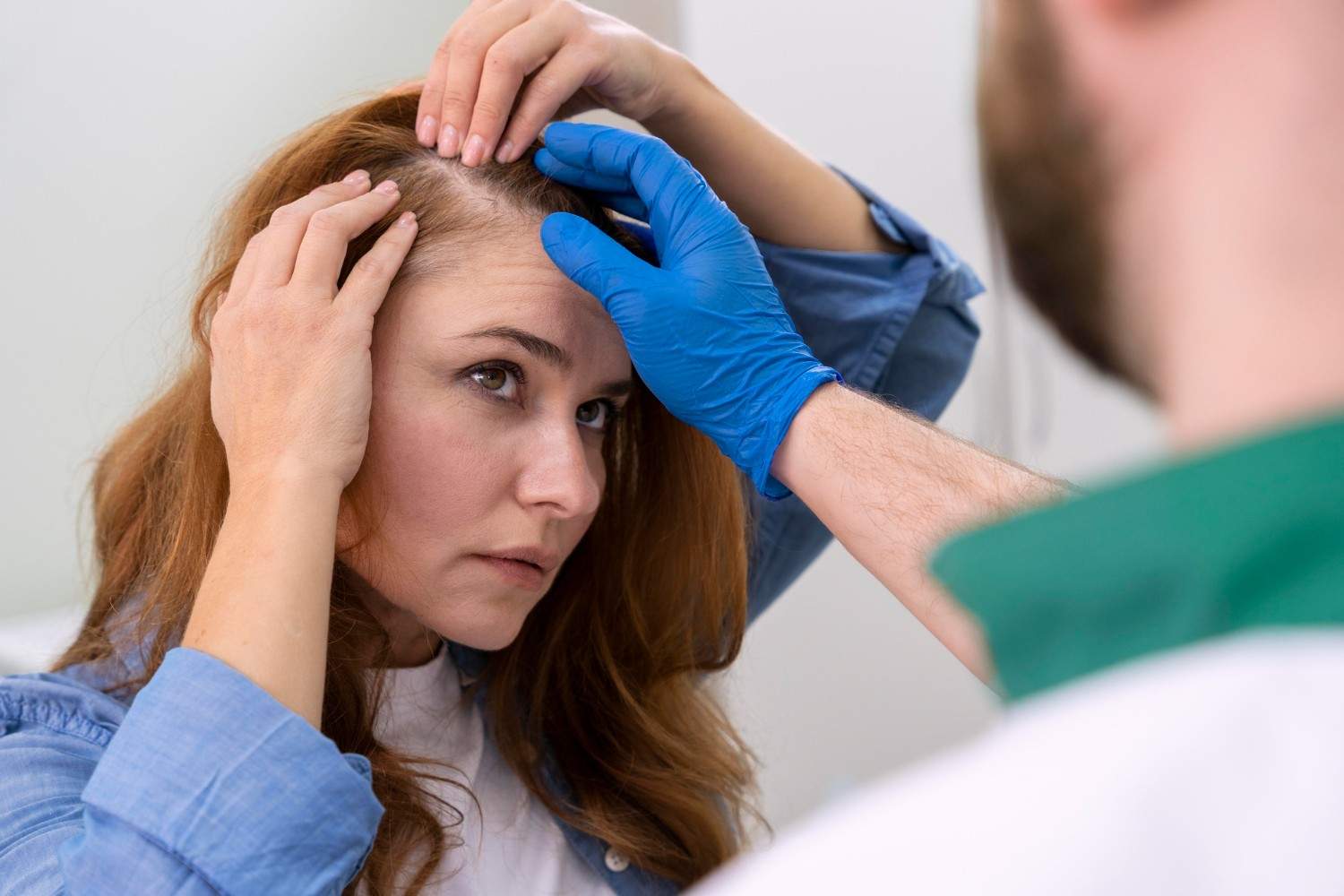fue hair hairline transplant for receding